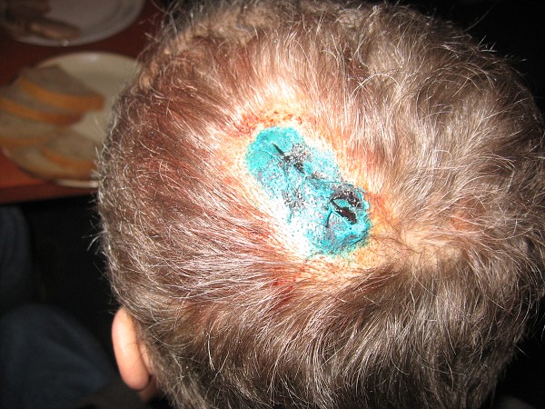 Nezdenice 16.1.2010